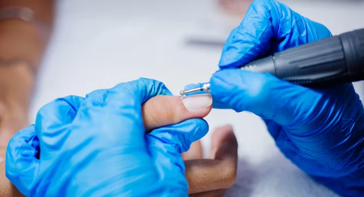 Nail Surgery